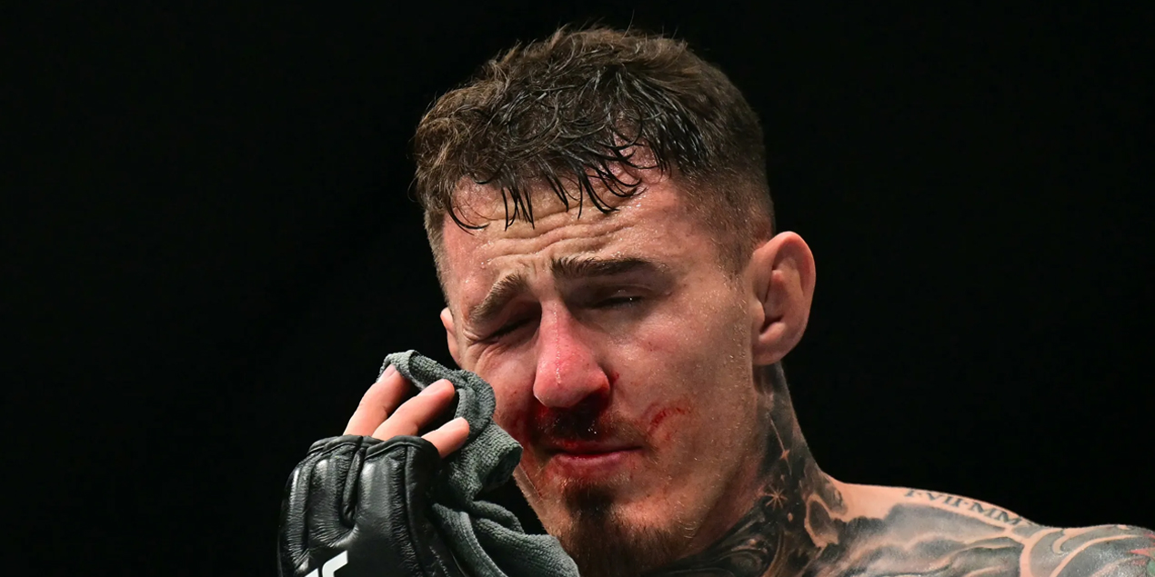 Отец Аспиналла: Том до сих пор ничего не видит одним глазом Отец Аспиналла: Том до сих пор ничего не видит одним глазом